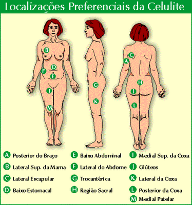 Tratamento Sugerido para celulite e estria.Nº 2